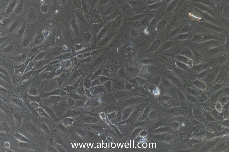 人肝窦内皮细胞永生化（IF鉴定）