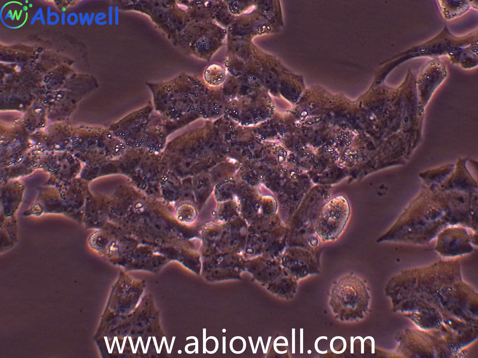 NCI-H295R (人肾上腺皮质腺癌细胞)(STR鉴定)
