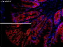 SQSTM1/p62 Mouse Monoclonal Antibody