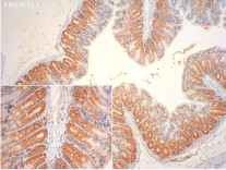 SQSTM1/p62 Mouse Monoclonal Antibody