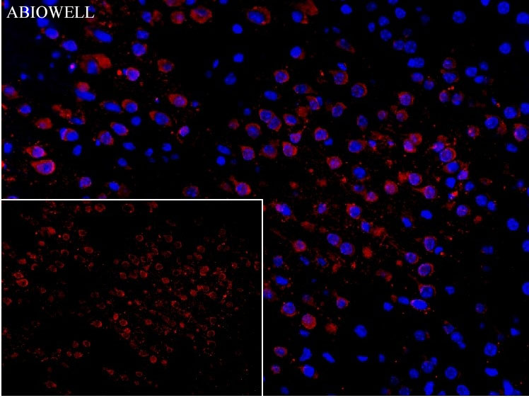 SQSTM1/p62 Mouse Monoclonal Antibody - 4