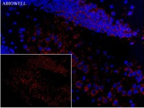 SQSTM1/p62 Mouse Monoclonal Antibody