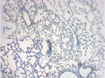 FOXP3 Mouse Monoclonal Antibody