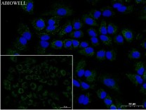 FDX1 Recombinant Rabbit Monoclonal  Antibody