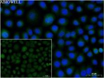 ATG5 Recombinant Rabbit Monoclonal  Antibody