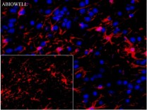 GFAP Recombinant Rabbit Monoclonal Antibody