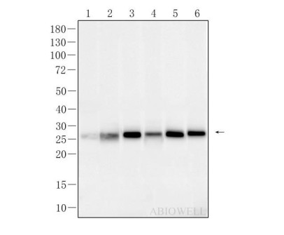 Bcl-2 Recombinant Rabbit Monoclonal  Antibody