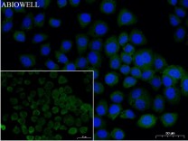 Bcl-2 Recombinant Rabbit Monoclonal  Antibody