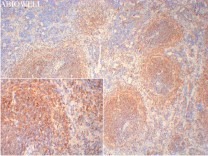 Bcl-2 Recombinant Rabbit Monoclonal  Antibody