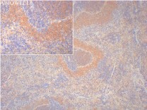 Bcl-2 Recombinant Rabbit Monoclonal  Antibody