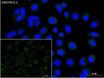 Caspase-3 Recombinant Rabbit Monoclonal  Antibody