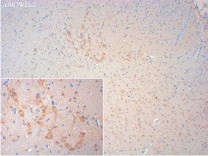 SQSTM1/p62 Mouse Monoclonal Antibody