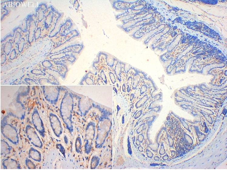 SQSTM1/p62 Mouse Monoclonal Antibody - 9