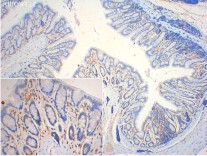 SQSTM1/p62 Mouse Monoclonal Antibody