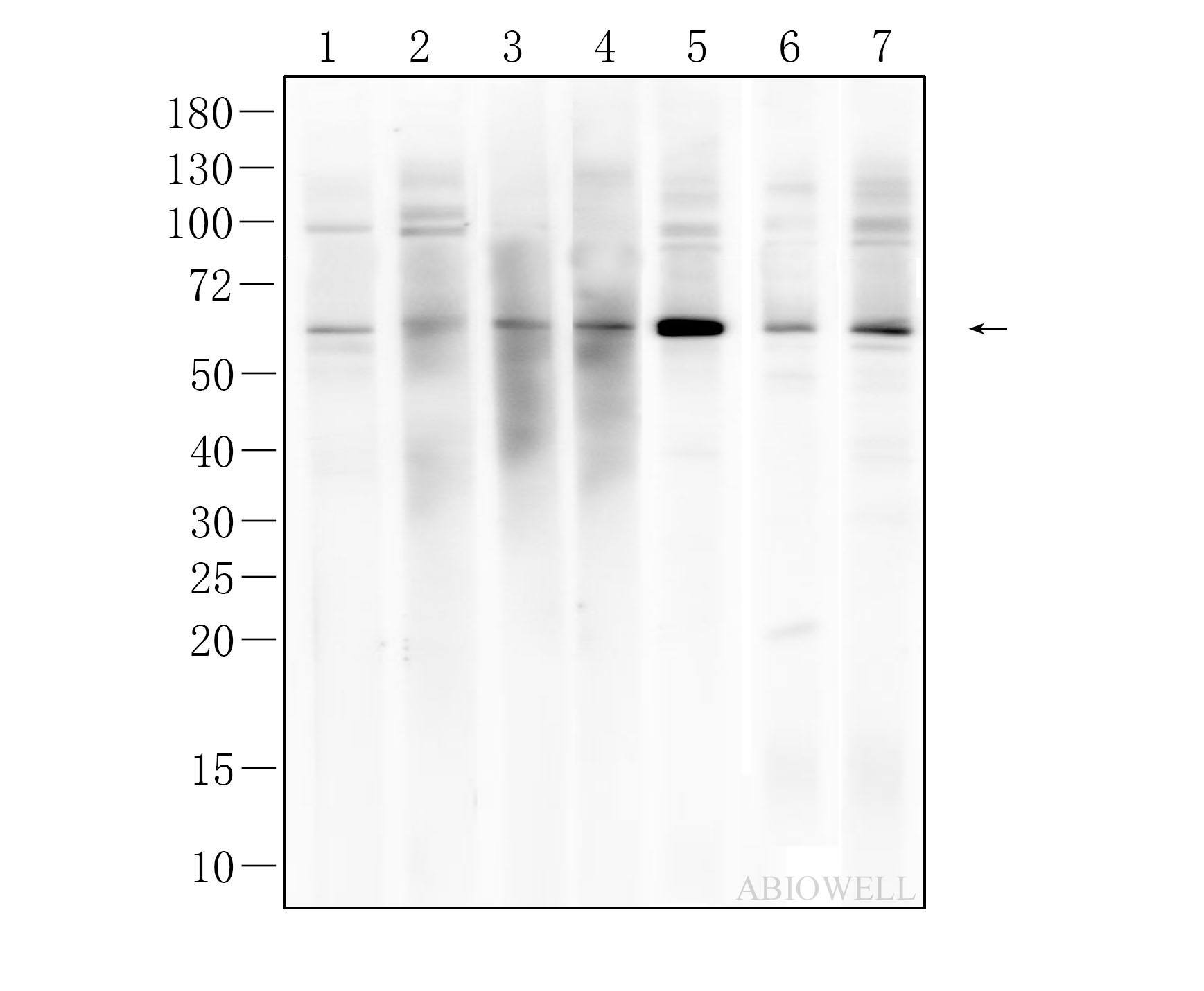 SQSTM1/p62 Mouse Monoclonal Antibody - 12