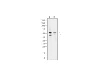 Galectin 8 Recombinant Rabbit Monoclonal  Antibody