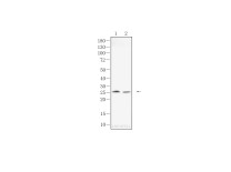 Bcl-2 Mouse Monoclonal Antibody