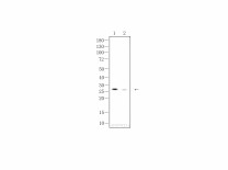 IL-1β Mouse Monoclonal Antibody