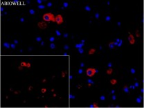 FACL4 Recombinant Rabbit Monoclonal Antibody