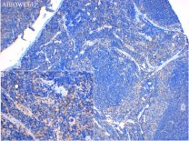 FACL4 Recombinant Rabbit Monoclonal Antibody