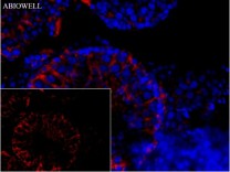 FACL4 Recombinant Rabbit Monoclonal Antibody