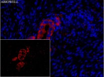 FACL4 Recombinant Rabbit Monoclonal Antibody