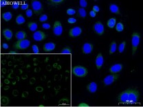 FACL4 Recombinant Rabbit Monoclonal Antibody