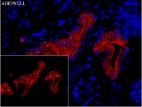 FACL4 Recombinant Rabbit Monoclonal Antibody