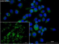 HLA-DR Recombinant Rabbit Monoclonal Antibody