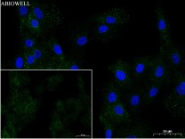 Integrin alpha 2 Recombinant Rabbit  Monoclonal Antibody