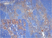 Integrin alpha 2 Recombinant Rabbit  Monoclonal Antibody