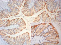 Bcl-XL Recombinant Rabbit Monoclonal  Antibody