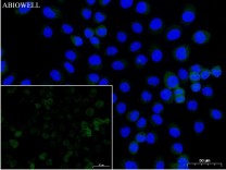 pro Caspase-7 Recombinant Rabbit   Monoclonal Antibody