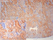 pro Caspase-7 Recombinant Rabbit   Monoclonal Antibody