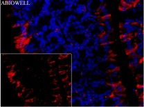 Ferritin Recombinant Rabbit Monoclonal  Antibody