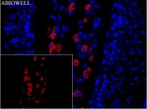 Ferritin Recombinant Rabbit Monoclonal  Antibody