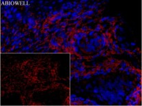 Ferritin Recombinant Rabbit Monoclonal  Antibody