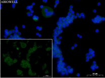 Ferritin Recombinant Rabbit Monoclonal  Antibody