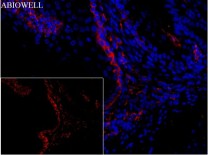 Ferritin Recombinant Rabbit Monoclonal  Antibody