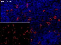 Ferritin Recombinant Rabbit Monoclonal  Antibody