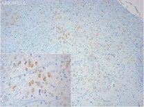 PTGER2 Recombinant Rabbit Monoclonal  Antibody