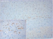 PTGER2 Recombinant Rabbit Monoclonal  Antibody