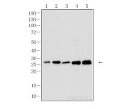 Bcl-2 Rabbit Polyclonal Antibody