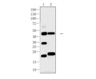 GFAP Rabbit Polyclonal Antibody