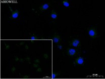 GFAP Rabbit Polyclonal Antibody