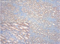 Nrf2 Rabbit Polyclonal Antibody