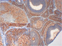 Nrf2 Rabbit Polyclonal Antibody