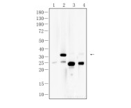 IL-1β Mouse Monoclonal Antibody