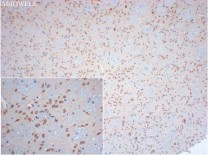 HPRT Recombinant Rabbit Monoclonal  Antibody