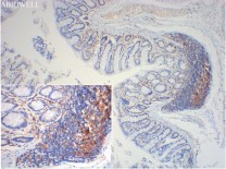 HPRT Recombinant Rabbit Monoclonal  Antibody